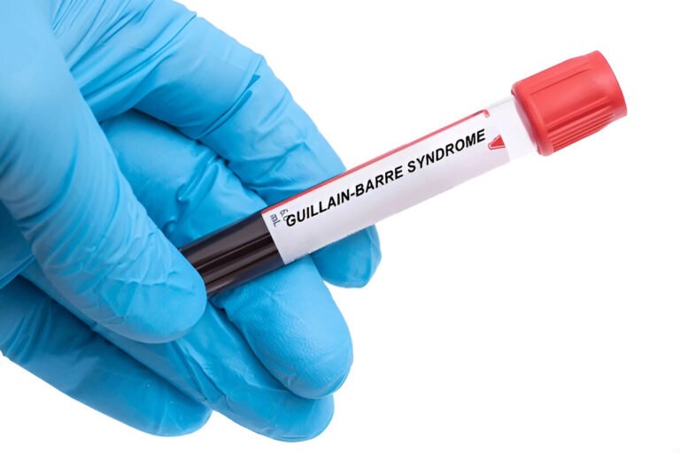 What Is Guillain Barre Syndrome? Know The Key Symptoms